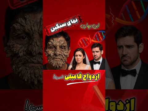 چرا ازدواج فامیلی خطرناک است
